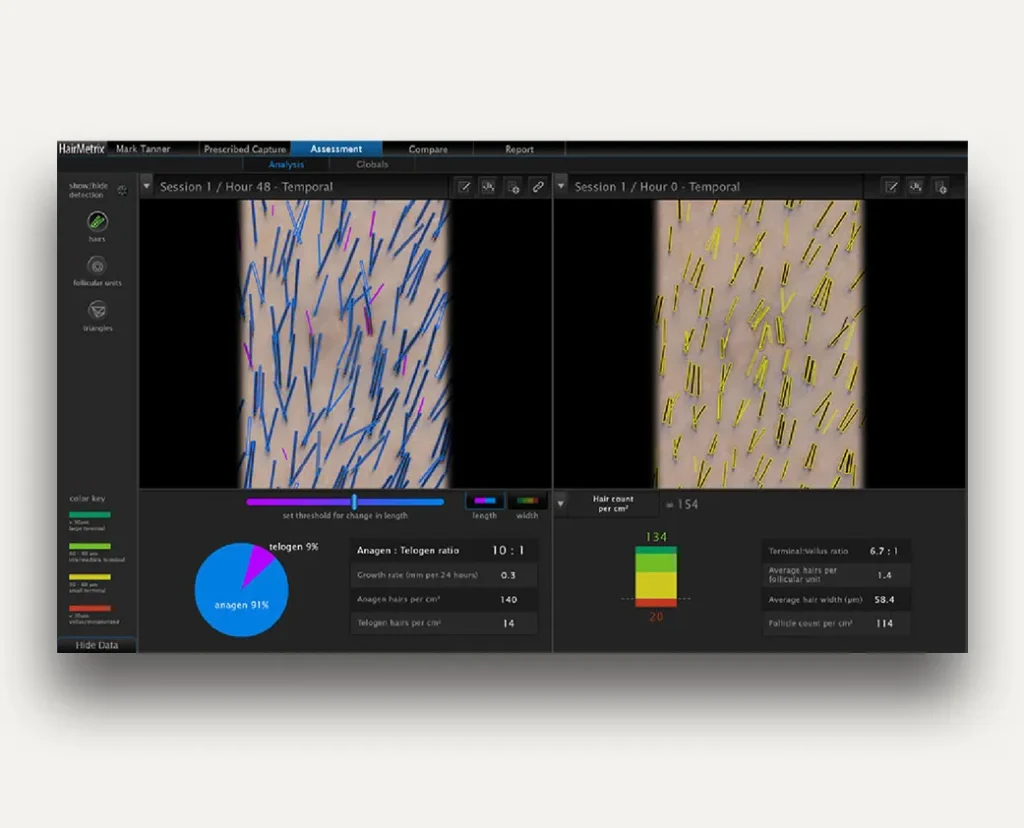 HairMetrix At CPT Advanced Hair Analysis HairMetrix At CPT Advanced Hair Analysis