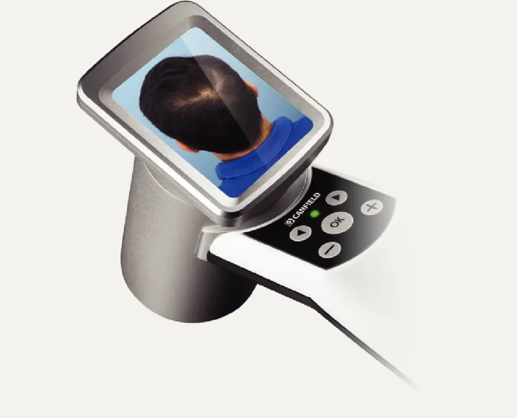 HairMetrix At CPT Advanced Hair Analysis HairMetrix At CPT Advanced Hair Analysis